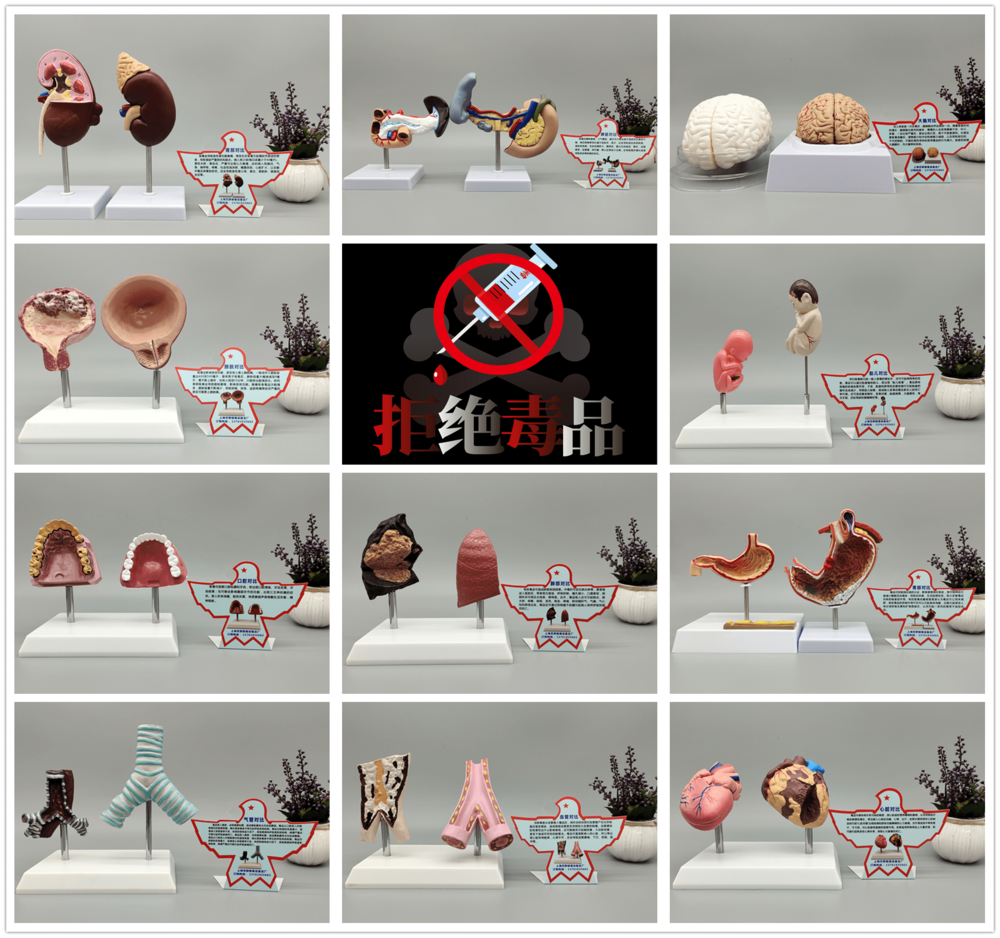 吸毒后器官變化對(duì)比.png